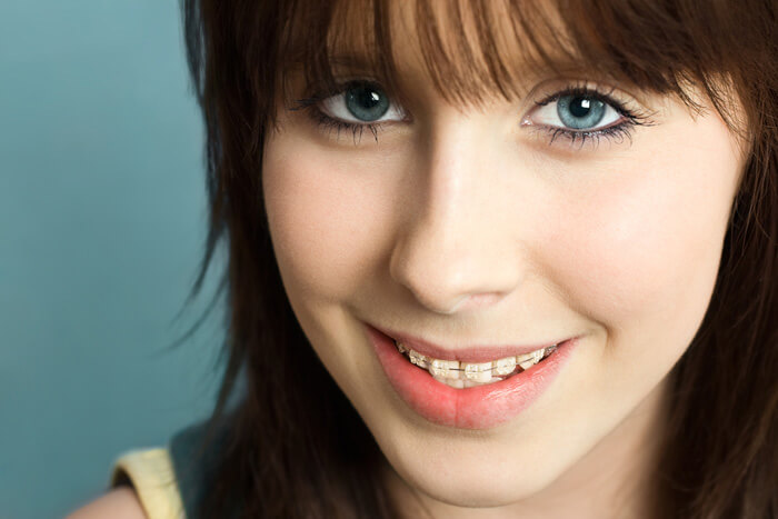 girl-with-braces