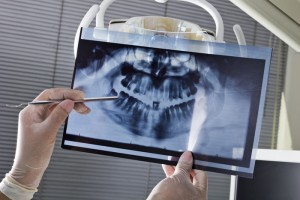 Dental imaging