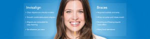 Invisalign vs Braces