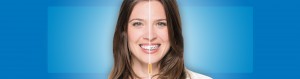 Invisalign vs braces
