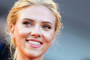 Scarlett Johansson with Braces