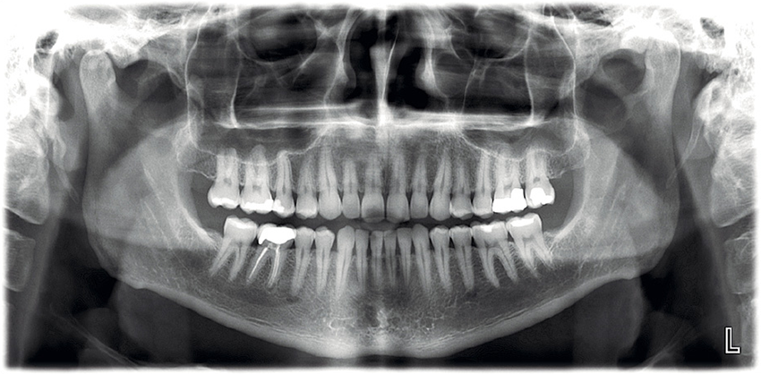 Low Dose Kid Friendly X-Ray Machine