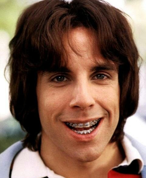 The-Best-Braces-Moments-in-Pop-Culture-History-Ben-Stiller