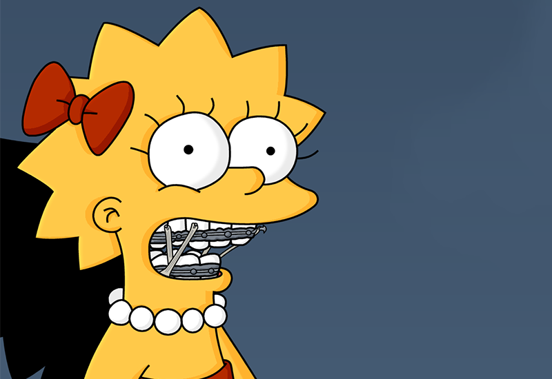 The Best Braces Moments in Pop Culture History