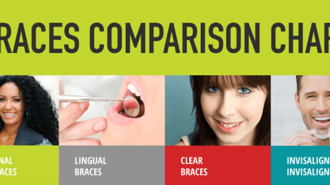 Invisalign Vs Braces Chart