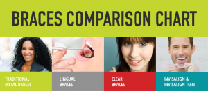 Braces comparison chart