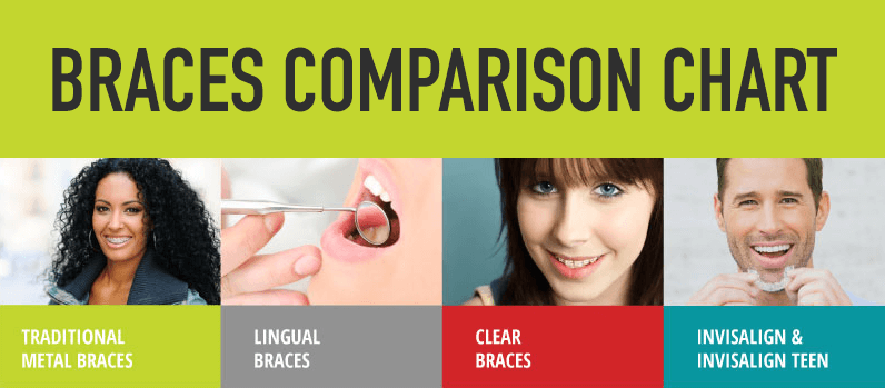 Braces comparison chart