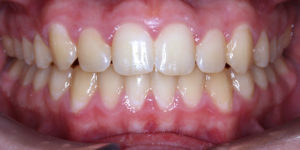 After Photo