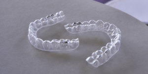 3M Clarity Aligners