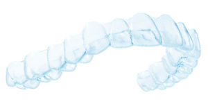 Spark Aligners